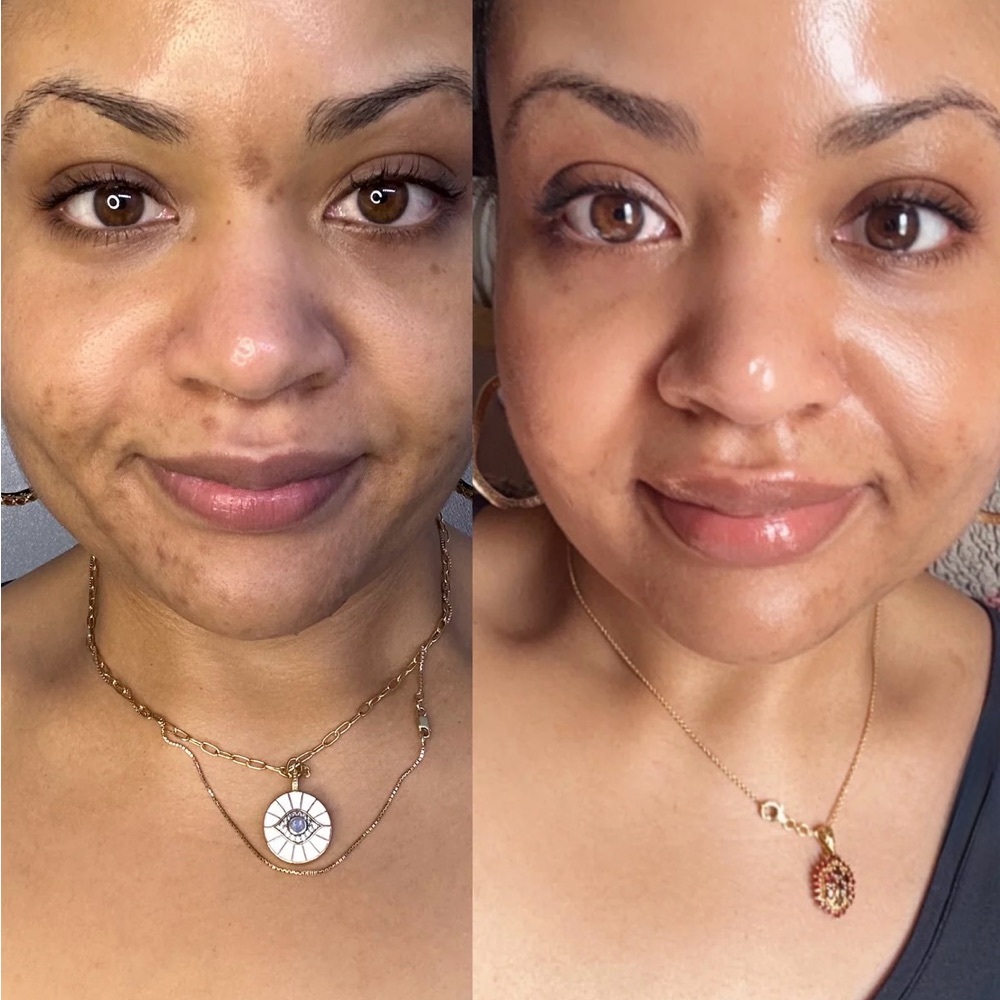 Byroe Celery AHA + LHA Serum - Picture 4 of 7